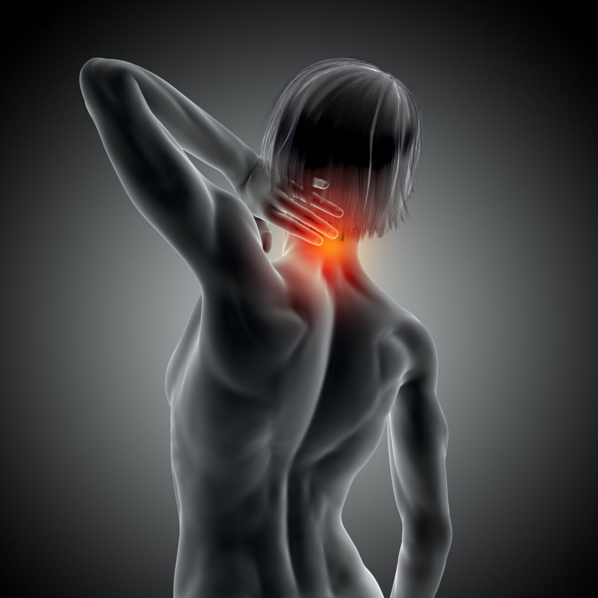 Understanding Neck Cracking