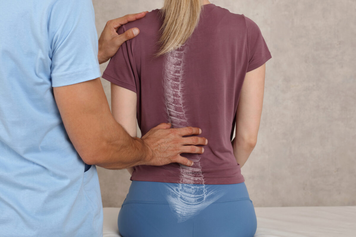 Treating Scoliosis with Physical Therapy